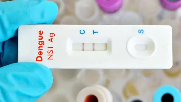 Ministério da Saúde inclui teste rápido de dengue no SUS